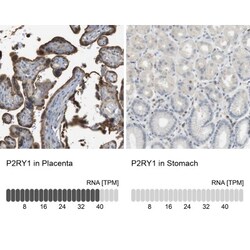 P2Y1/P2RY1 Antibody, Novus Biologicals 25 &mu;L; Unlabeled:Antibodies,